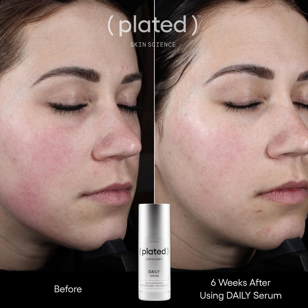 Plated Daily Serum