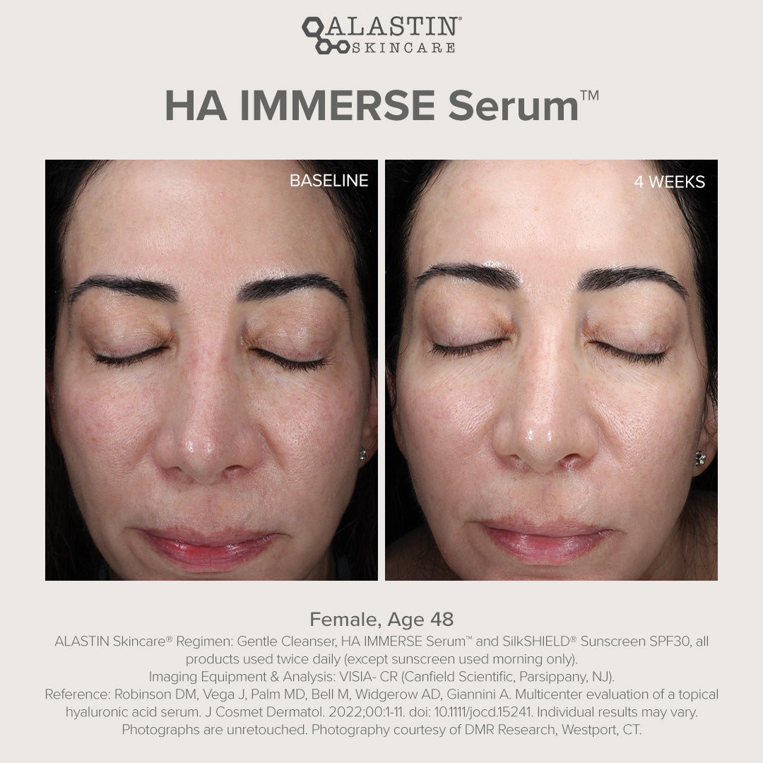 Alastin - HA (Hyaluronic Acid) IMMERSE Serum